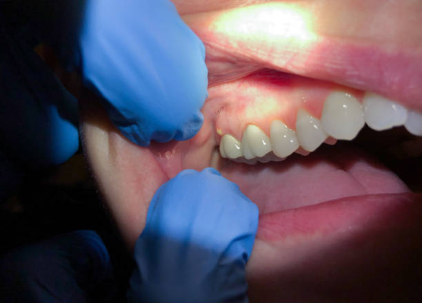 Best Emergency Cosmetic Dentistry (e.g., broken veneers) in Roland, OK