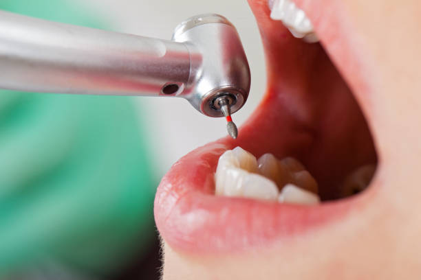 Best Broken or Chipped Tooth Repair in Roland, OK